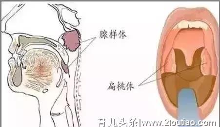 小宝宝鼻塞的痛苦比大人放大了100倍，这2大秘诀让孩子畅快呼吸