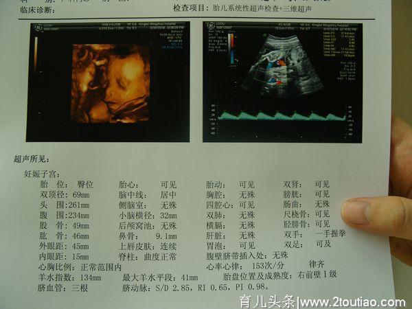 产检正常，为何宝宝出生是畸形？关于孕检，准妈妈要知道的两点