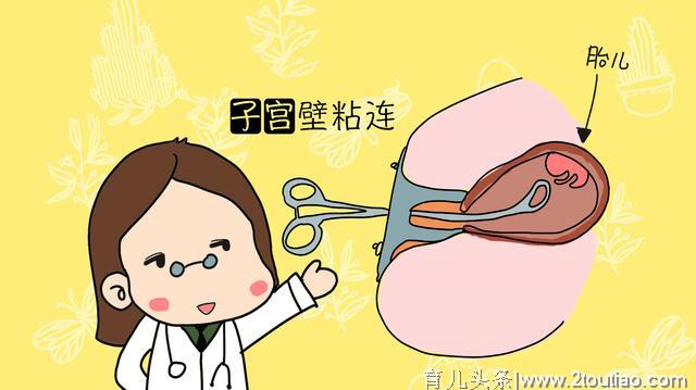 剖腹产有“后遗症”，能顺尽量别剖，别等到生二胎时才后悔