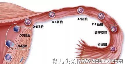 宫外孕，无法忘却的痛