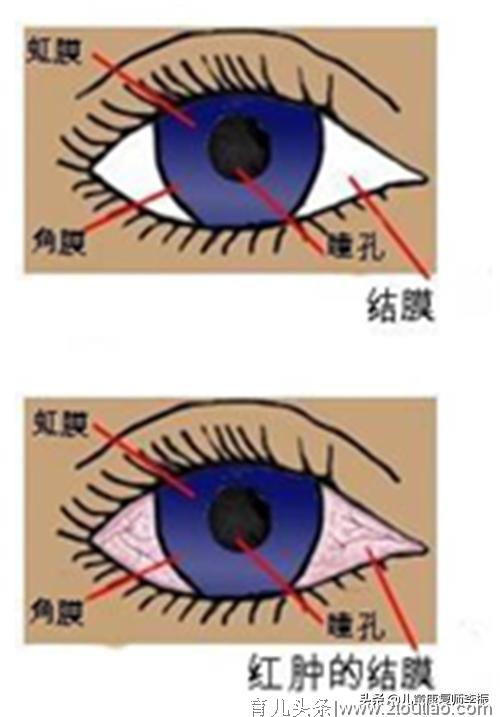 哪些疾病会影响宝宝智力？家长们记好了，一定要预防这几种！