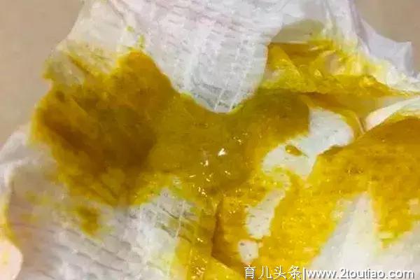 新手父母第一课：手把手教你察言观色识便便（超全合集）