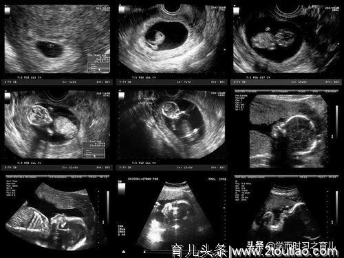 怀孕5个多月还没有胎动，有可能是这几个原因，看你属于哪一种