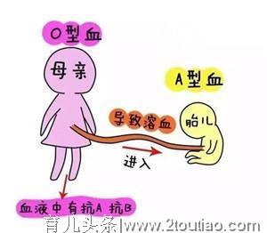 学点新生儿黄疸知识，新手妈妈不用慌！宝宝黄疸应该这样做