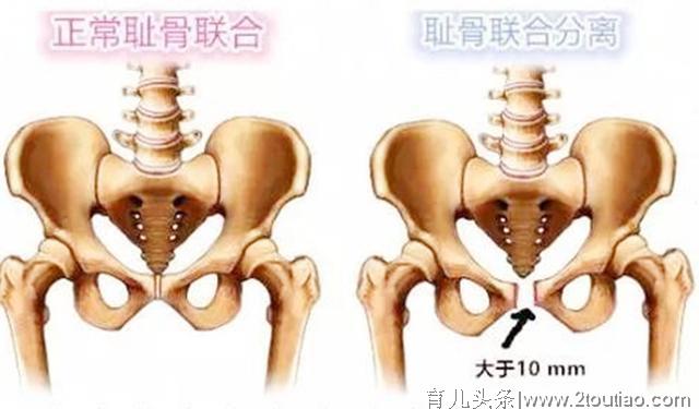 产后第一年，也是新手妈妈“最难熬”的一年，你过得好吗