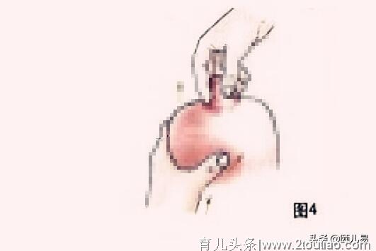 催奶按摩的手法示意图 下奶效果立竿见影