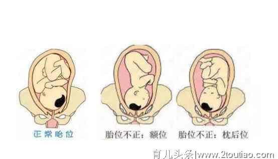 这三类产妇顺产特别快，快来看看你是不是其中的一类