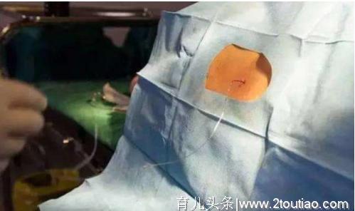 女性一生中到底能承受多少次的“剖腹产”？大夫的话直接告诉了你