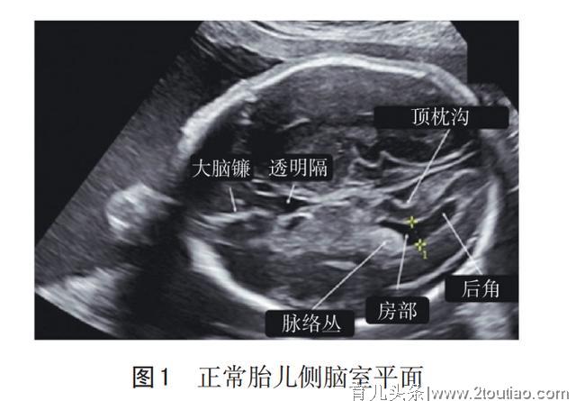 孕期四维彩超，检查报告的这几点能看懂，胎儿小秘密就了如指掌了