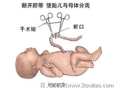 顺产真的比剖腹好吗，孕晚期有这七种迹象的孕妈要慎重选择了！