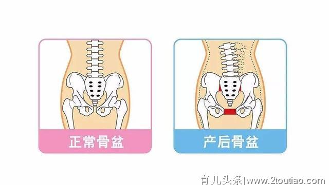 产后那些事