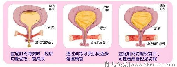 产后恢复到底有没有用？这个钱到底该花不该花？