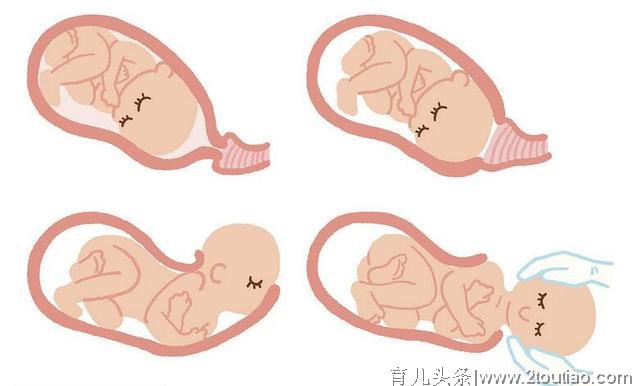 顺产和剖腹产哪个更痛？答案：谁用谁知道