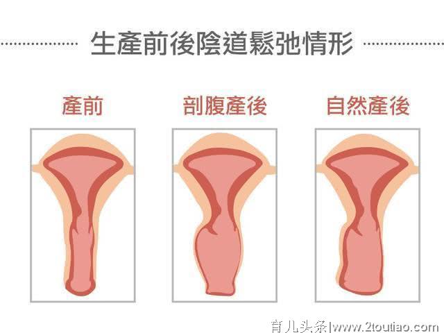 分娩选顺产真的会变松吗？产后常做4个瑜伽动作，让你产后无忧