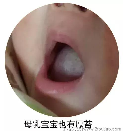 如何观察孩子的色相，调整孩子的健康状态