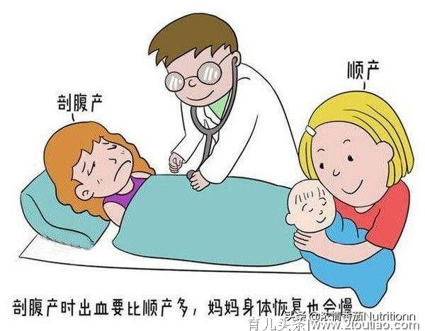 剖腹产与自然分娩哪个好？