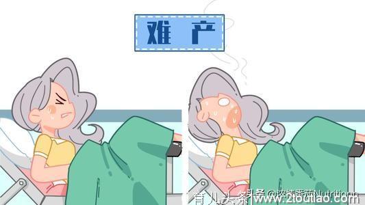 剖腹产与自然分娩哪个好？