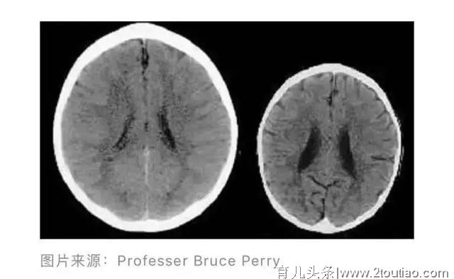 那些被打骂的孩子，智商正发生惊人变化