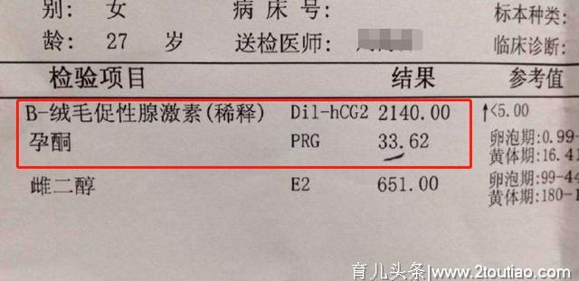 刚怀孕需要做哪些检查，多少天去医院做B超？孕早期检查攻略送你