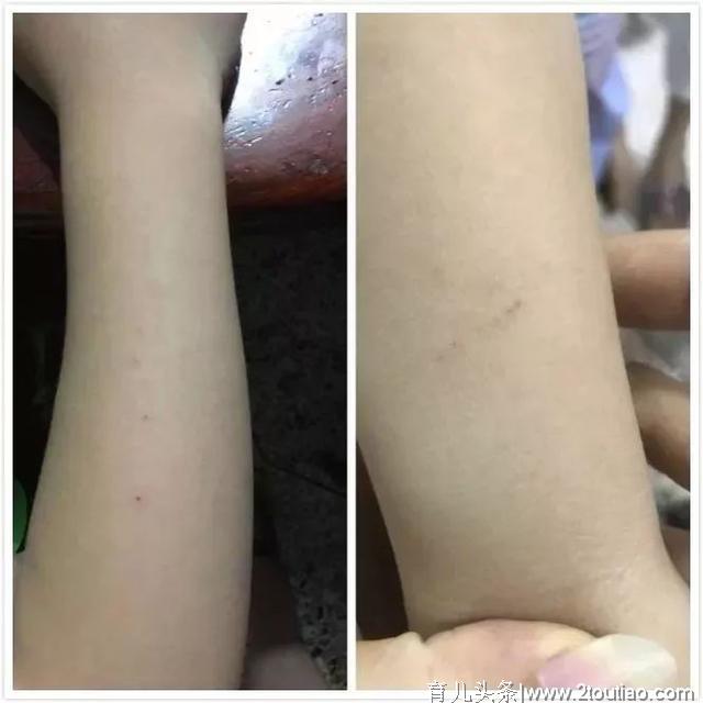 快讯 | 幼儿园保育员用胸花小别针扎幼儿！检察机关已提前介入