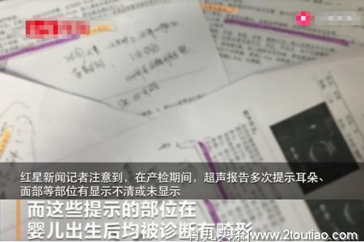 孕妇生严重畸形儿，医院称无责，网友：全责！我怀孕看6次才让走