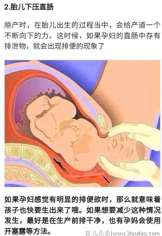 产妇在分娩时，为啥会边生，边“拉臭臭”？医生：没事都一样