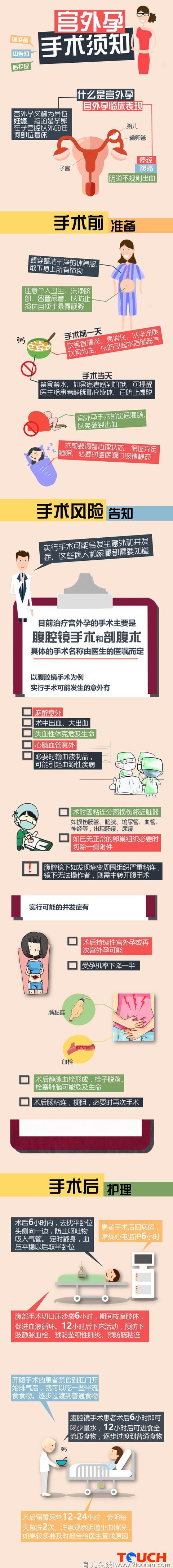 当妈妈遇上宫外孕——宫外孕手术前后须知