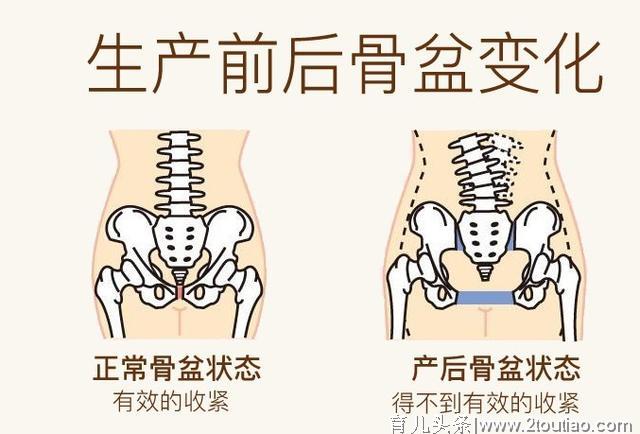 顺产一定比剖腹产更疼，是真的吗？顺产的4大谣言，你信了几个