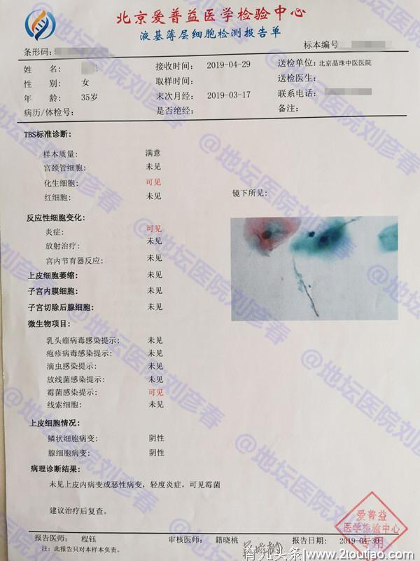 「病例」不想要孩子就做好措施，一次次的流产伤害的是自己的健康