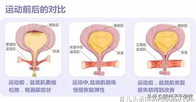 「产后恢复」瑜伽，您最好的产后修复