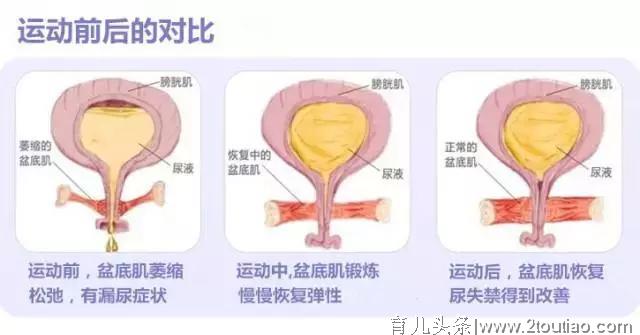 「大连产后恢复」瑜伽，您最好的产后修复