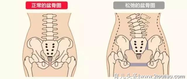 4招瑜伽帮你恢复产后骨盆