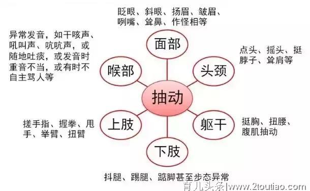 孩子总爱“挤眉弄眼”？不是调皮，有可能患了抽动症