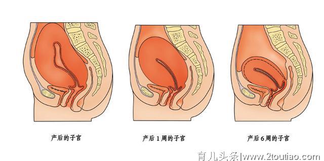 产后恢复子宫恢复不全3大特征，产后子宫恢复注意这4点