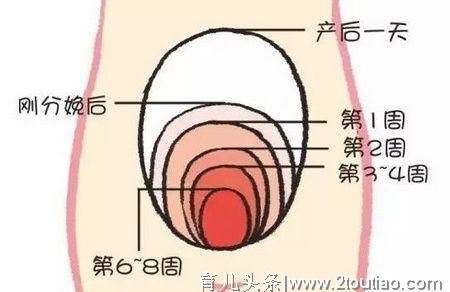 产后恢复子宫恢复不全3大特征，产后子宫恢复注意这4点