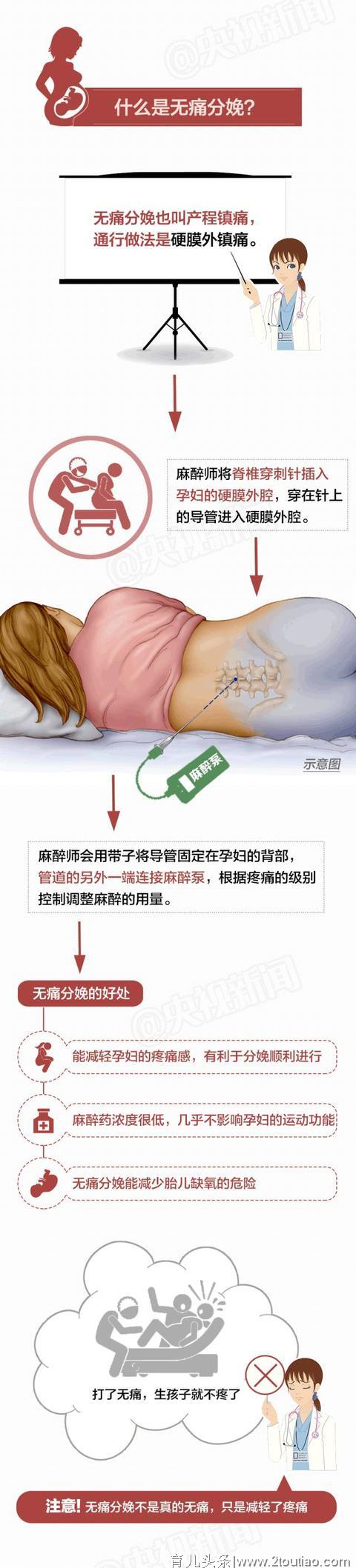 顺产和剖宫产到底怎么选？哪个恢复得更快？一图带你全讲解