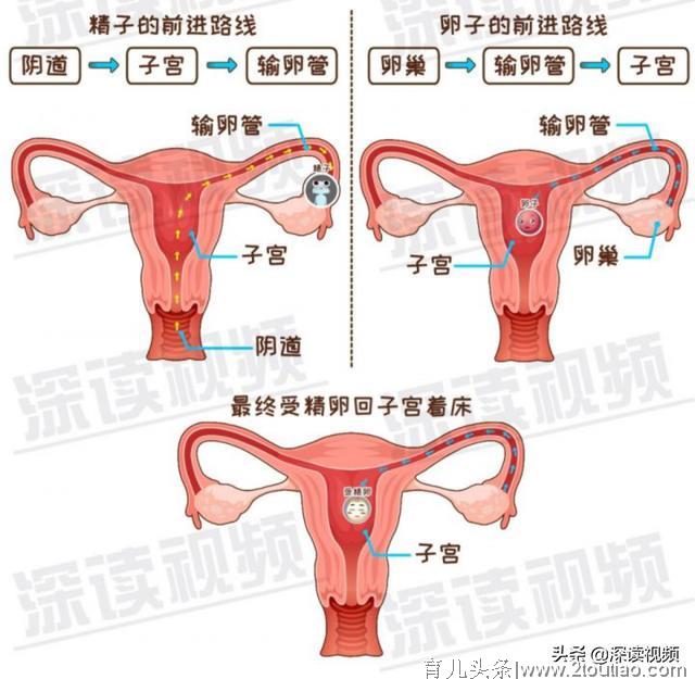 宫外孕是怎么回事儿？