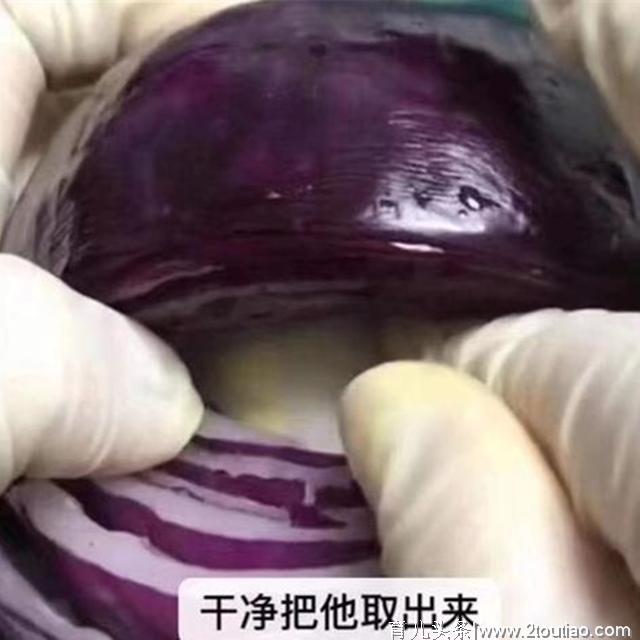 剖腹产就是“睡一觉”那么轻松？看这颗洋葱，才知道为母则刚