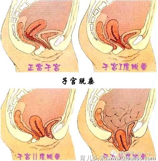 产后营养　产后贫血？秘籍全在这了！