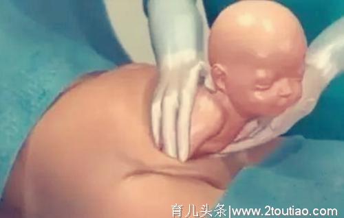 女性“剖腹产”全过程，7张3D图太真实，男性好好看看，劝你珍惜