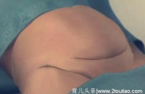 女性“剖腹产”全过程，7张3D图太真实，男性好好看看，劝你珍惜