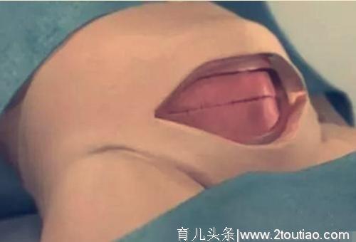 女性“剖腹产”全过程，7张3D图太真实，男性好好看看，劝你珍惜