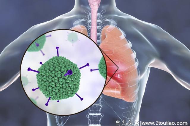 说到肺炎，这8个重要的医学常识，每个人都应该知道