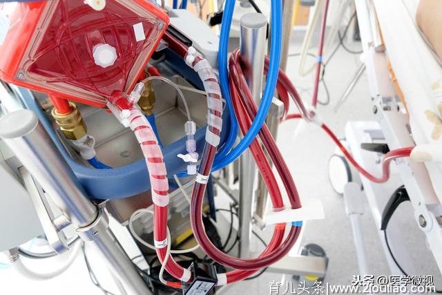 ECMO：新型冠状病毒肺炎患者最后治疗方法之一，它究竟是怎么回事