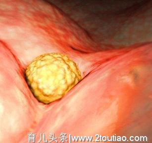 3D高清组图播放：孕期胎儿发育全过程，胎宝：百米赛跑跟爸妈见面