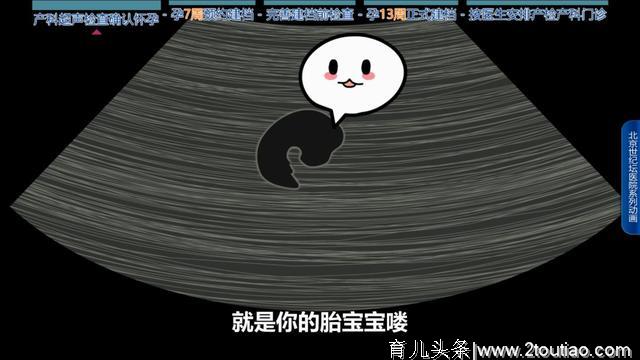 【科普动画】怀孕了，该做什么准备？