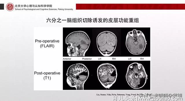 北大教授：过度识字影响学龄前儿童想象力