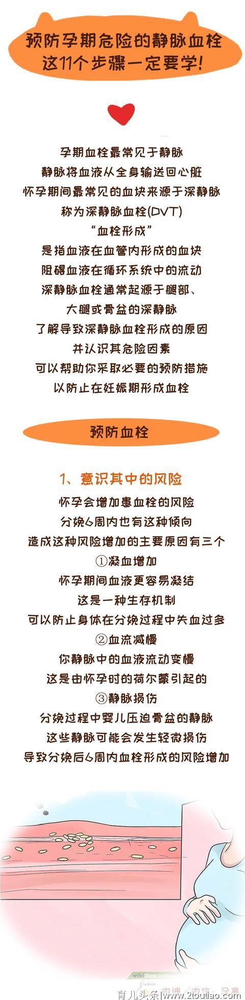 预防孕期危险的静脉血栓，这11个方法学起来