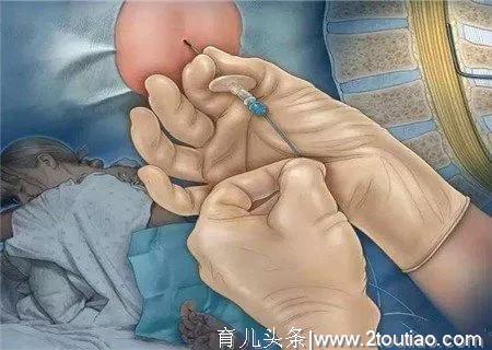 组图揭秘剖腹产全过程，张张戳心，能忍到最后一张的都是女战士